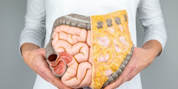 cancer-colon-1-750x375