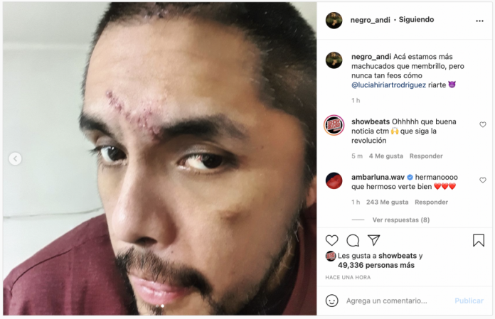 Portavoz reapareció en sus redes tras el accidente que lo tuvo internado Portavoz reapareció en sus redes tras el accidente que lo tuvo internado