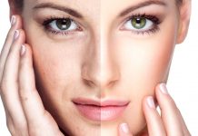 rejuvenecer rostro