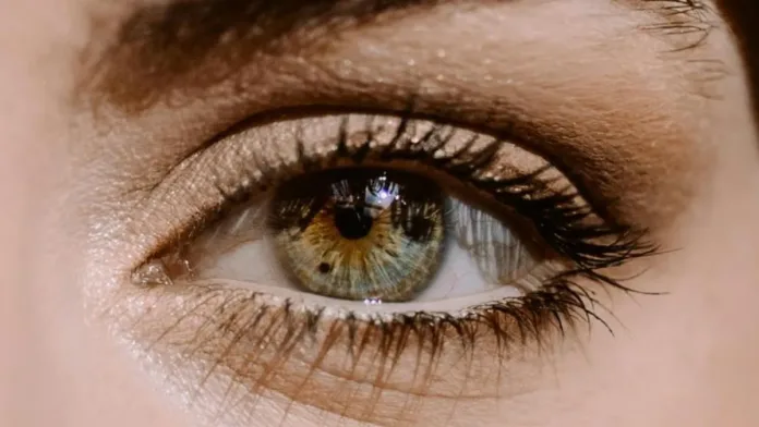 Descubre si las pecas oculares pueden ser melanoma y sus síntomas a considerar. Descubre si las pecas oculares pueden ser melanoma y sus síntomas a considerar.