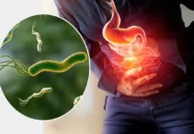 Bacteria que afecta al 70% de la población y está relacionada con el cáncer.