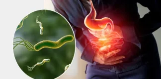 Bacteria que afecta al 70% de la población y está relacionada con el cáncer.