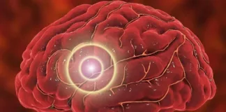 Estimulación cerebral transcraneal en casa: una nueva esperanza contra la depresión.