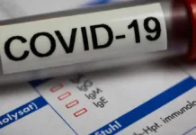 Aumento del riesgo cardíaco en casos graves de COVID y antecedentes de enfermedades.