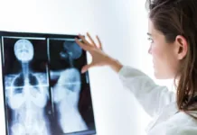 Soledad Fandiño comparte su lucha contra el cáncer de mama: síntomas y tratamientos.