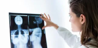 Soledad Fandiño comparte su lucha contra el cáncer de mama: síntomas y tratamientos.