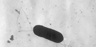 Alerta sanitaria: listeria en productos Cousine&Co y Daily Fresh