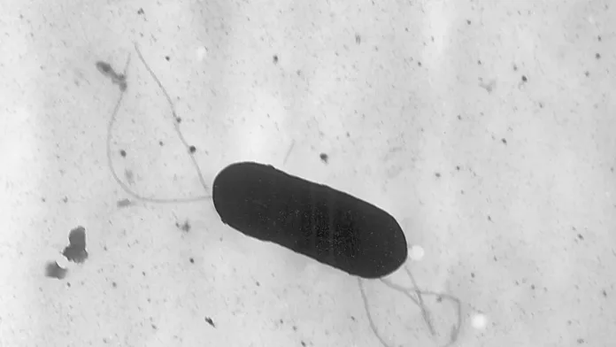 Alerta sanitaria: listeria en productos Cousine&Co y Daily Fresh Alerta sanitaria: listeria en productos Cousine&Co y Daily Fresh