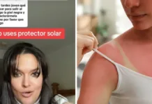 La dermatóloga alerta sobre los riesgos de no usar protector solar en redes sociales.