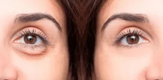 Descubre los mejores remedios caseros para eliminar las ojeras de forma efectiva.