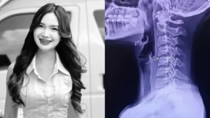 La cantante tailandesa falleció tras un masaje: riesgos de las torsiones cervicales. La cantante tailandesa falleció tras un masaje: riesgos de las torsiones cervicales.