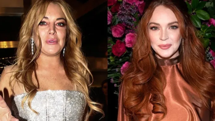Lindsay Lohan: teorías sobre su sorprendente transformación estética. Lindsay Lohan: teorías sobre su sorprendente transformación estética.