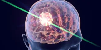 Una innovadora linterna molecular para detectar tumores cerebrales y trastornos.