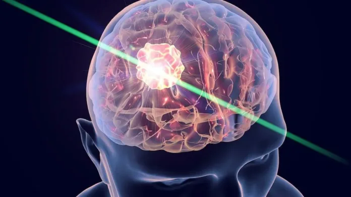 Una innovadora linterna molecular para detectar tumores cerebrales y trastornos. Una innovadora linterna molecular para detectar tumores cerebrales y trastornos.