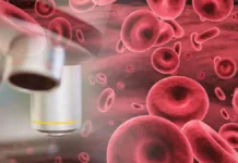 Un análisis de sangre: clave para detectar diversas enfermedades a tiempo.