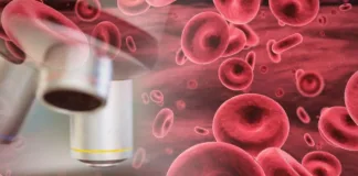 Un análisis de sangre: clave para detectar diversas enfermedades a tiempo.