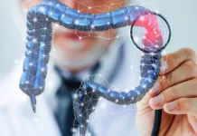 Aumento alarmante del cáncer de colon en personas menores de 50 años.