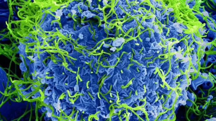 La piel: un nuevo hallazgo en la transmisión del virus Ébola. La piel: un nuevo hallazgo en la transmisión del virus Ébola.