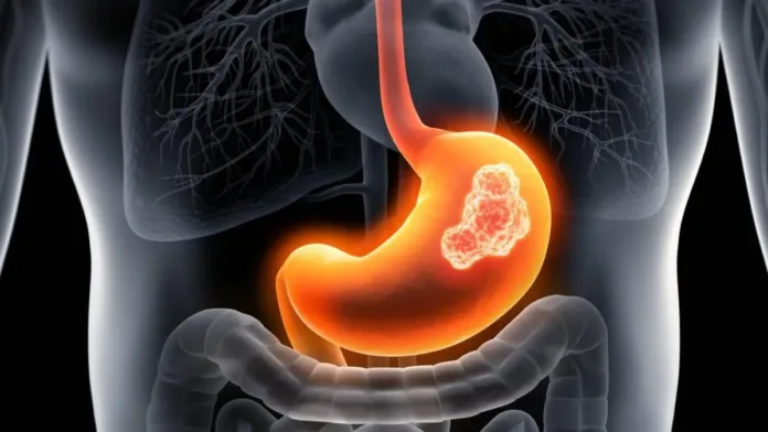 Investigadores revelan cómo el sistema nervioso afecta el cáncer de estómago. Investigadores revelan cómo el sistema nervioso afecta el cáncer de estómago.