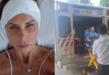 Mariel Aereboe denuncia negligencia tras grave accidente en hotel de Viña del Mar.