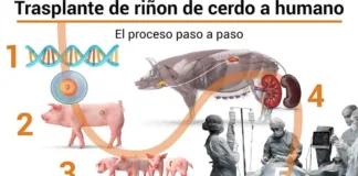 Explorando los xenotrasplantes como alternativa a la escasez de órganos.