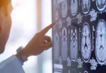 Los científicos revelan la edad crítica del deterioro cerebral acelerado.